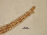 7 - Dettaglio della cellula apicale